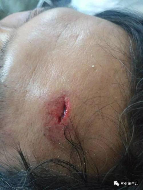 老澳门最新开奖结果今天和游客三亚被蛇咬身亡与三亚被蛇咬了